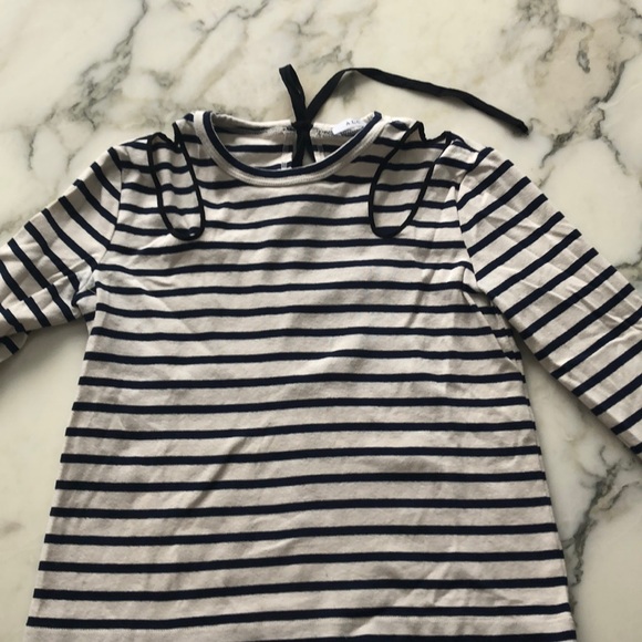 ALC striped top Xs - Picture 2 of 7